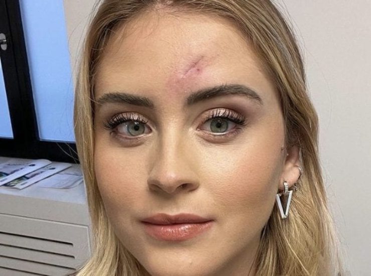 valentina ferragni operazione-Solospettacolo