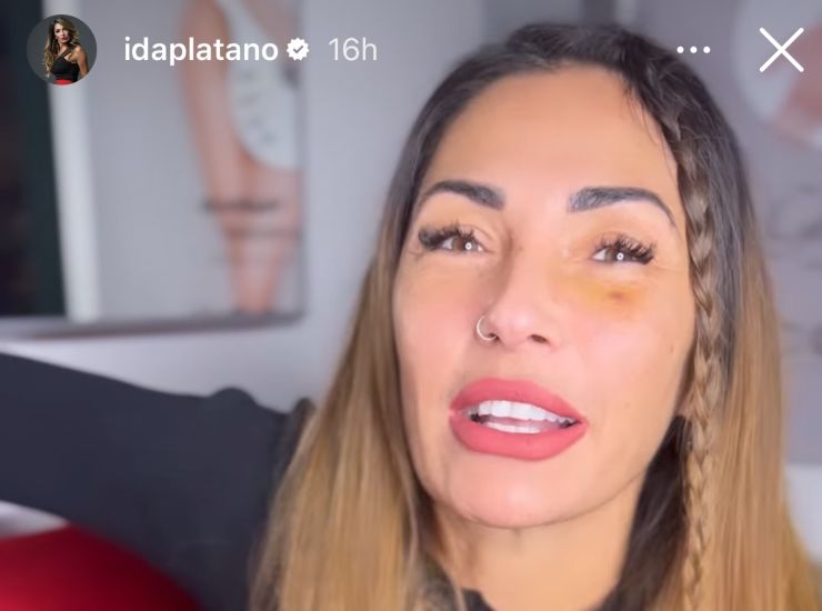 ida platano livido-Solospettacolo